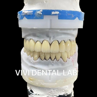 Couronnes de laboratoire dentaire numérique CAD CAM Translucide couronne en zirconium en couches