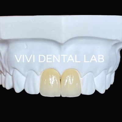 Dentiste à mâchoire complète Zirconia Bridge Implantation de couronne Translucide Esthétique