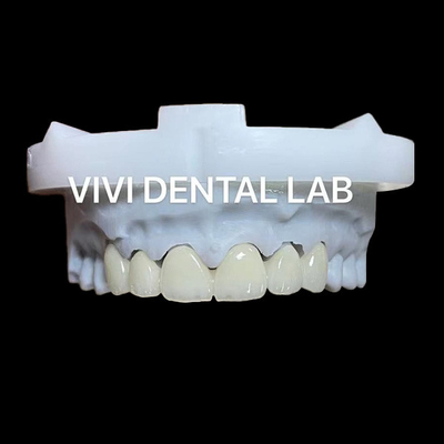 La couronne dentaire en zirconium en couches et la translucide 3D PRO