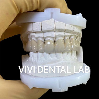 Des couronnes de laboratoire dentaires de précision esthétiques en porcelaine de zirconium couronne dentaire