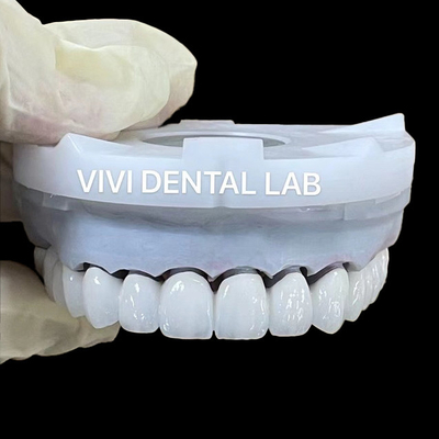Des couronnes de laboratoire dentaires en zirconium blanc 3D PRO PFZ Noritake Porcelaine