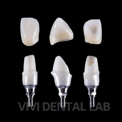 Implant dentaire Tibase Zirconia Abutment Titane précision personnalisée