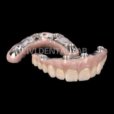 Couronne d'implant dentaire en zirconium biocompatible avec une barre de titane