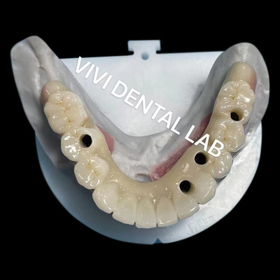 Puits à vis en zirconium multicouche Biocompatible sur la structure métallique