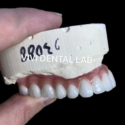 Naturel à l' aspect esthétique vis retenu Zirconia implant couronne durable