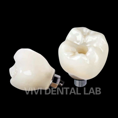 Croix d'implant dentaire à vis PFZ en porcelaine en zirconium en couche
