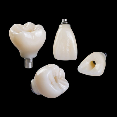 Implantation dentaire professionnelle en zirconium couronne de titane CAD CAM