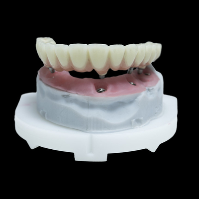 Tout sur 4 PFM implant dentaire couronne de titane Zirconia tout sur 6 restaurations