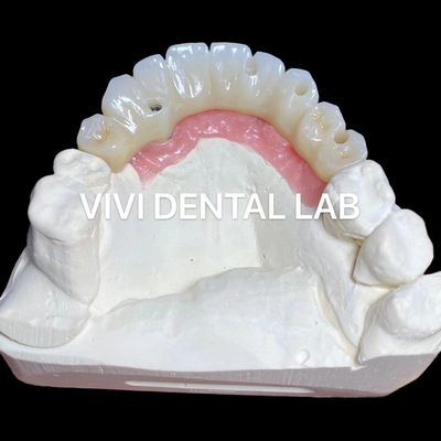 PMMA Précision plein pont en zirconium sur les abutments à plusieurs unités