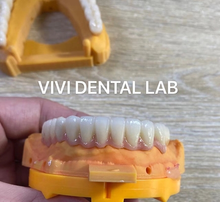 Dentiste à mâchoire complète Zirconia Bridge Implantation de couronne Translucide Esthétique