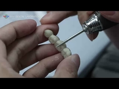 Pont métallique céramique