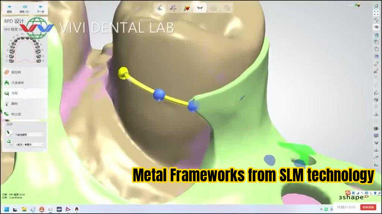 LA CHINE VIVI DENTAI LABORATORY certifications