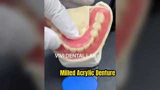 Prothèse acrylique fraisée de haute qualité